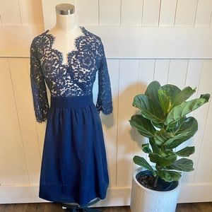 *40% off* Beautiful Lace Dress